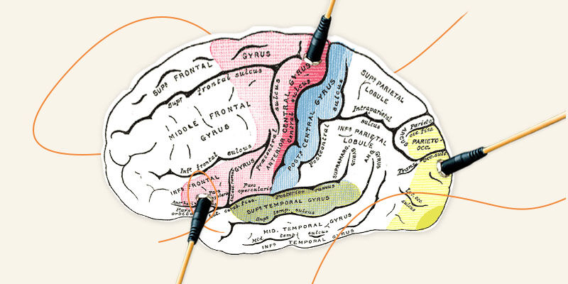 VUI.blog – Sound in Voice User Interfaces – illustration of a brain